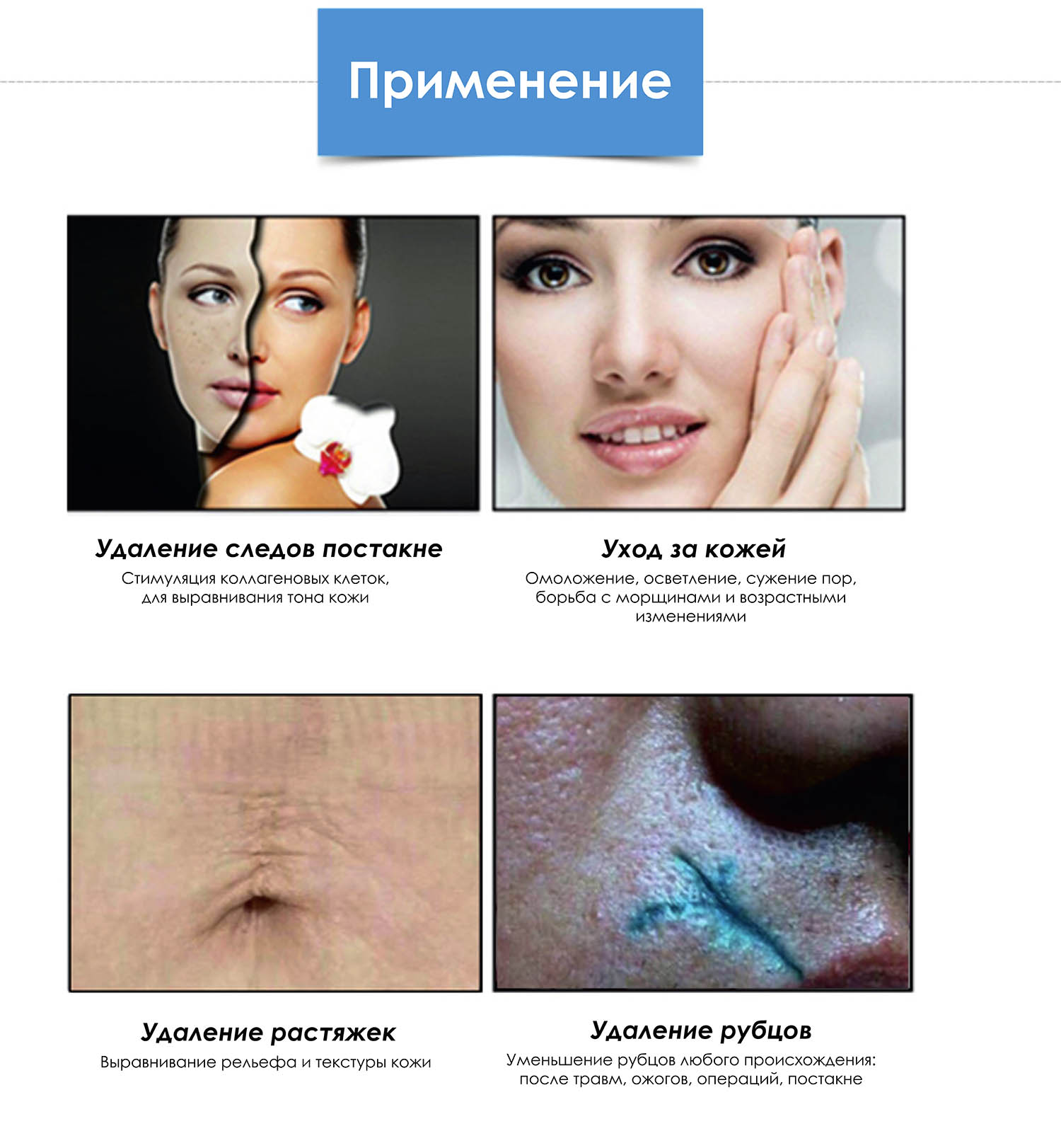Области приминения Области приминения